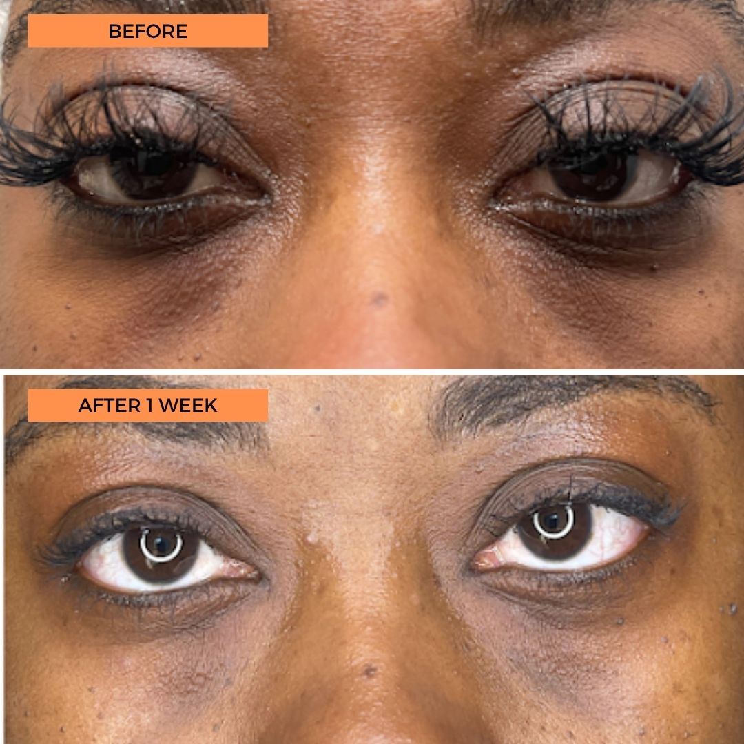 Universal C Eye Perfector