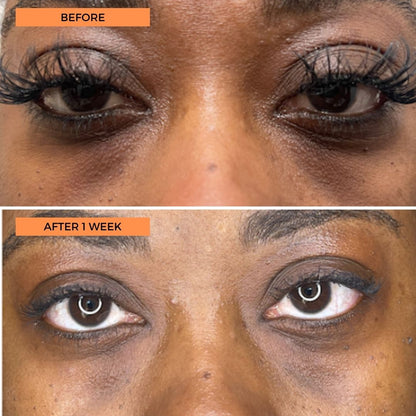 Universal C Eye Perfector