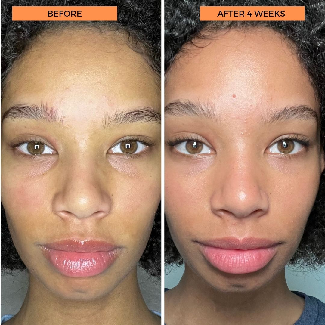 Universal C Eye Perfector