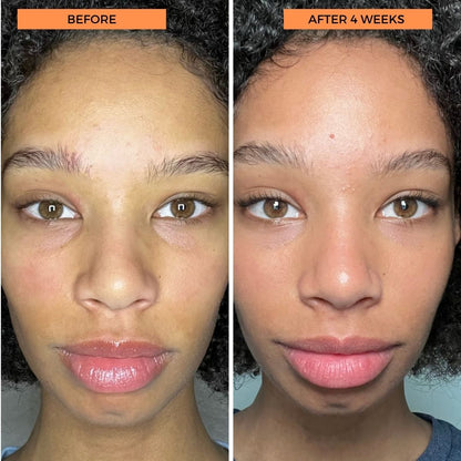 Universal C Eye Perfector