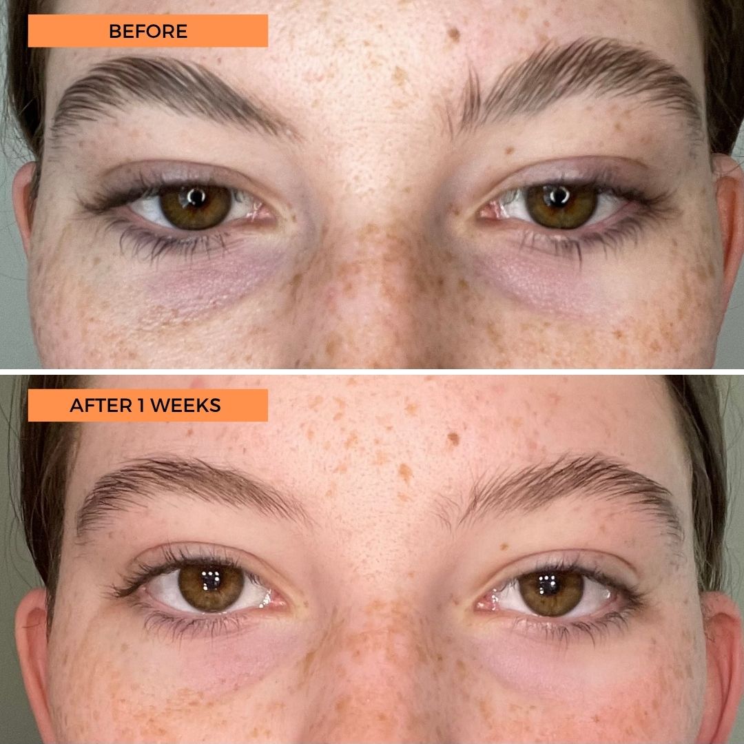 Universal C Eye Perfector