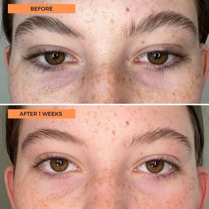 Universal C Eye Perfector