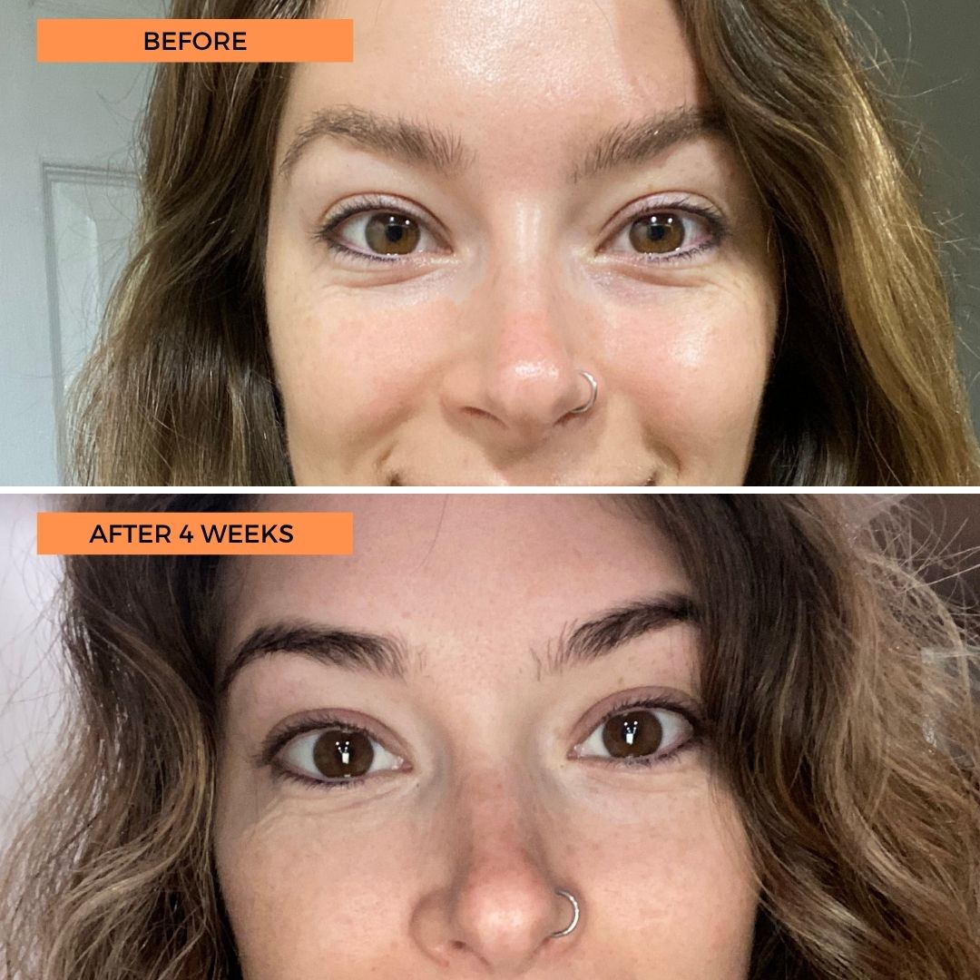 Universal C Eye Perfector