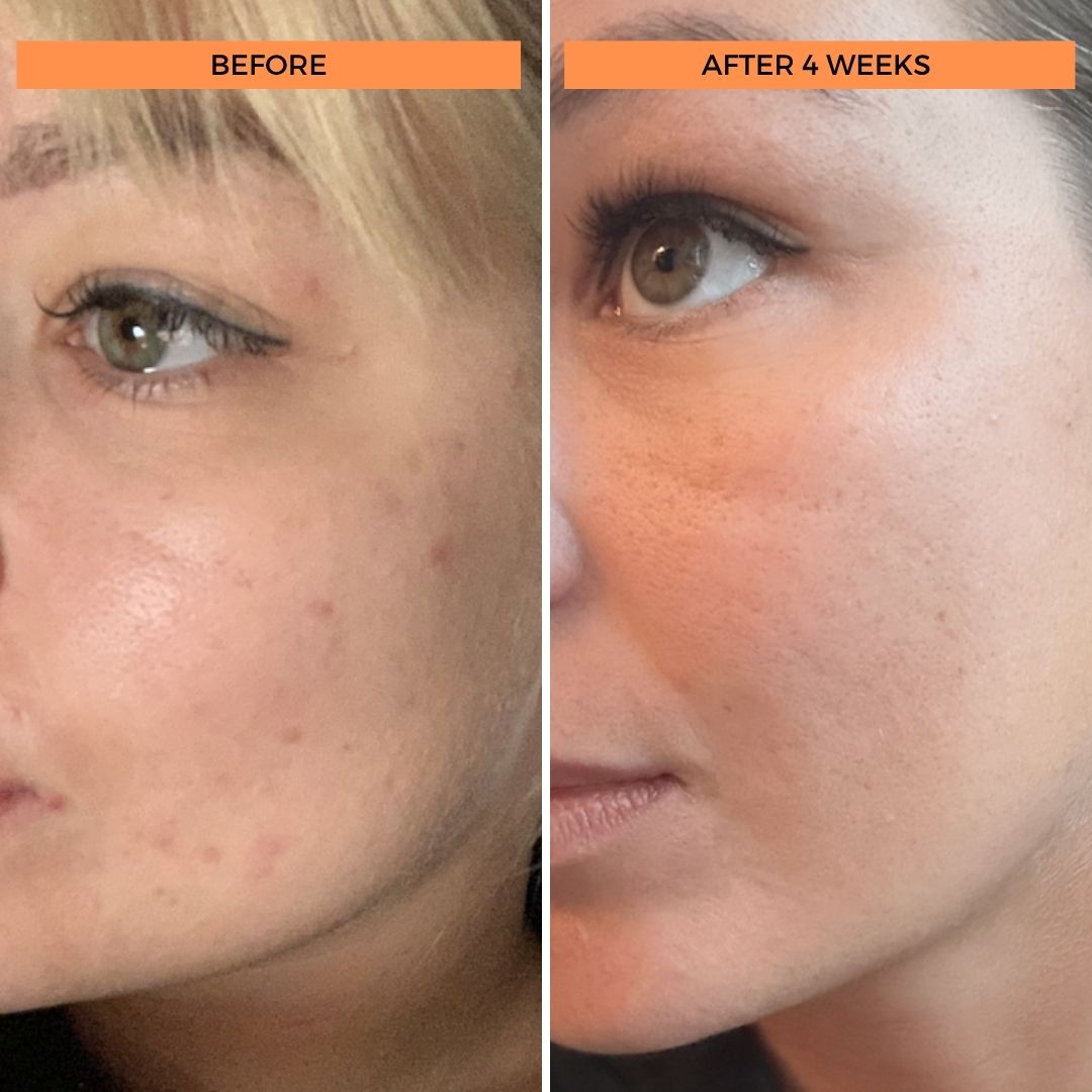 Universal C Skin Refiner