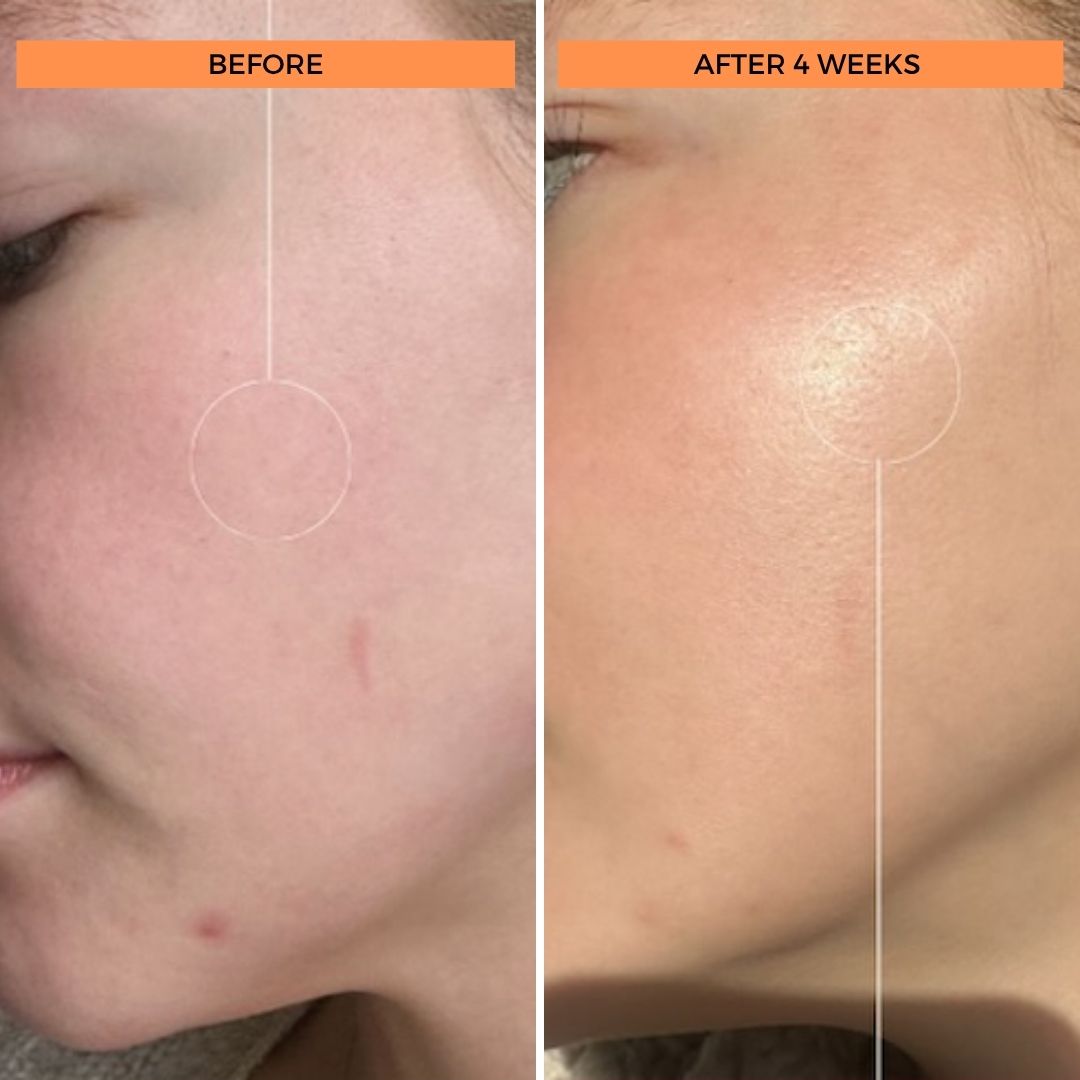 Universal C Skin Refiner