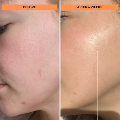 Universal C Skin Refiner