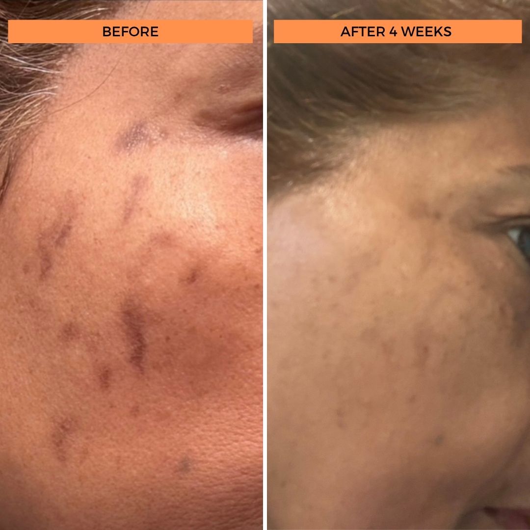 Universal C Skin Refiner