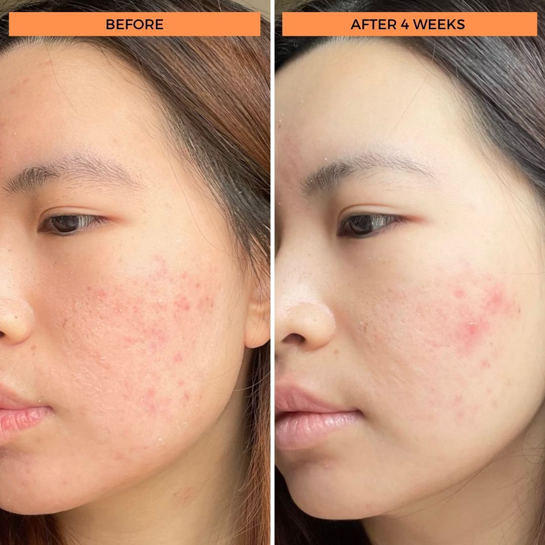 Universal C Skin Refiner