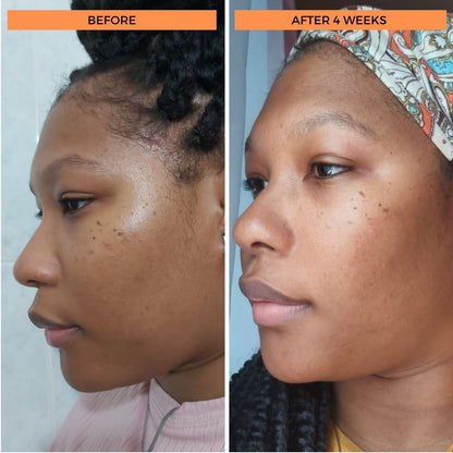 Universal C Skin Refiner