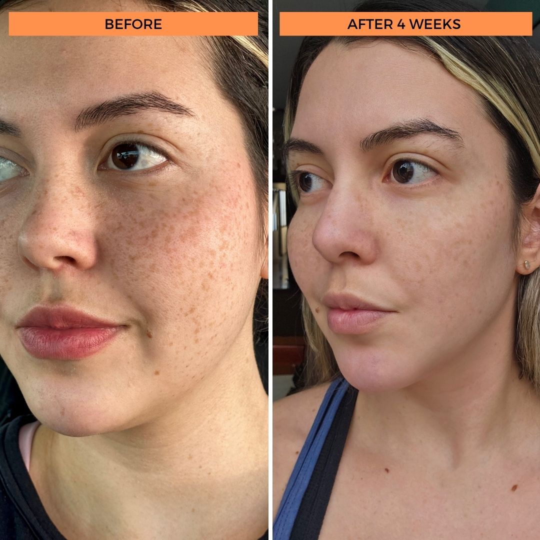 Universal C Skin Refiner